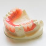 ３歯以上の欠損に対するミラクルデンチャー